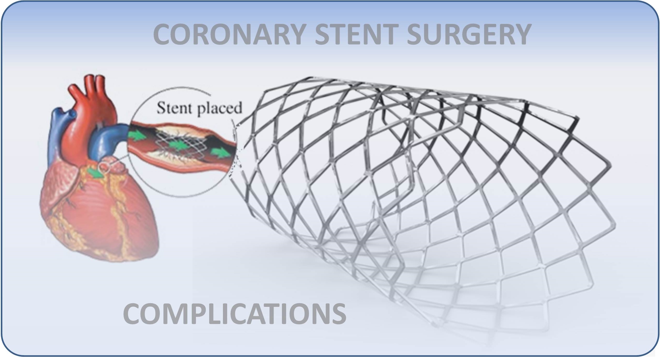 Human heart with stent. Text reads 'Coronary Stent Surgery Complications